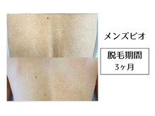 メンズビオ 神戸三宮店/