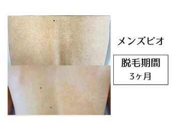 メンズビオ 神戸三宮店/