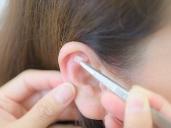 ビジョイ(VIJOY)/針は使用しません♪