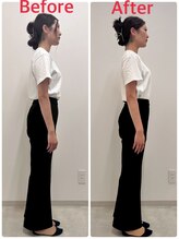 月の木整骨院/【施術後の変化】