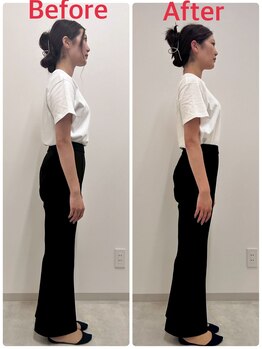 月の木整骨院/【施術後の変化】