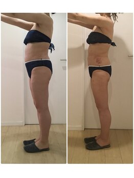 ビーアンベリィ(bee embellie)/