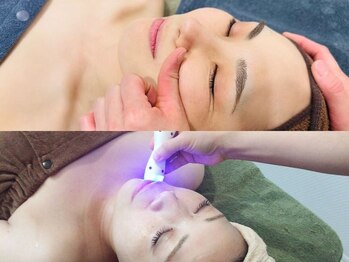 アイディエム 新宿店(IDM)の写真/【小顔コルギ】頭筋+顔筋コルギ（首肩ケア付）5225円★RF筋膜リリース付で戻りにくいIDM式コルギは9800円！