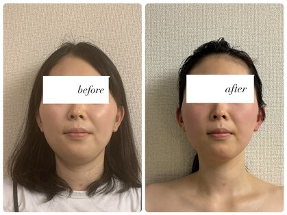 モテ肌 小顔コルギサロン カムトゥルー(come true)の写真