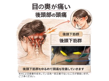 たけ鍼灸院 新所沢の写真