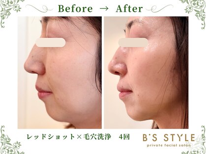 ビーズスタイル(B’S STYLE)の写真