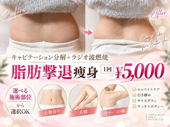 ルピナス 立川店の写真/キャビテーション&ラジオ波痩身5000円！超音波と振動で脂肪をしっかり分解◎リバウンドが不安な方にも♪