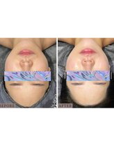 エクスクラメーションマーク(!!!)/トーンアップと肌質改善◎