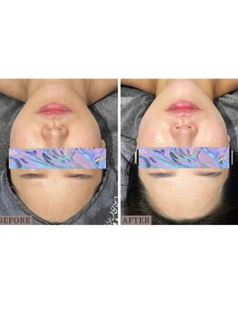 エクスクラメーションマーク(!!!)/トーンアップと肌質改善◎