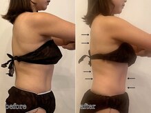 エビアス(Evias)/疲れもすっきりサイズダウン