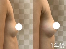 ハレオラ(HaleOla)/40代☆バストケア