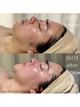 サロン ド ブラン アオヤマ(Salon de BLANC AOYAMA)/クリスティーナビオフィート