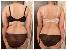 クイーンズ ピュア 長崎店(Queen's Pure)/ほっそり二の腕スリムコース