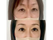 ニュアンス アイラッシュ(NUANCE eyelash)/スゴイゲンラッシュ＋ハリウッド