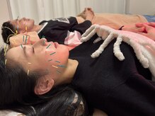 エテルニテ(eternite)の雰囲気（大切な催し事に向けてのメンテナンスに！ご夫婦での美容鍼も◎）
