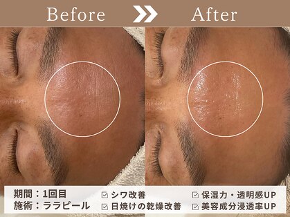 ファッショニスタ 恵比寿東口(Fashionista)の写真