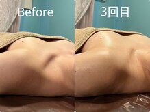 アム(Am.)/バストケア/バストアップ