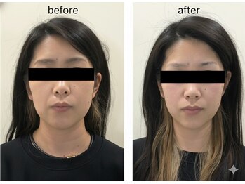 クローバー治療院