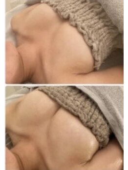 スマイルクルー(SmileClue)/ビフォーアフター症例