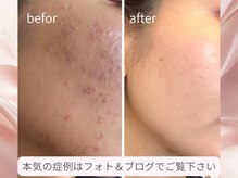 ファシル(Facile)