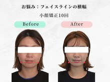 ウェリナ平和堂長久手院/小顔矯正/骨盤矯正/痩身/整体