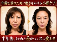 沢山の有名モデルさまや海外のお客さまもご来店の世界が認めたリアル小顔小頭矯正と痩身と美肌サロンです!!