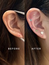 シロ(silo.)/お顔と頭皮に幹細胞導入♪