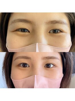 シャンティ(Shanti)/ヘッドスパとアイブロウお手入れ