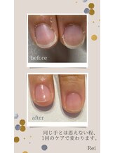 レイ(Rei)/爪の大きさが変わります！