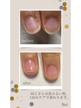 レイ(Rei)/爪の大きさが変わります!
