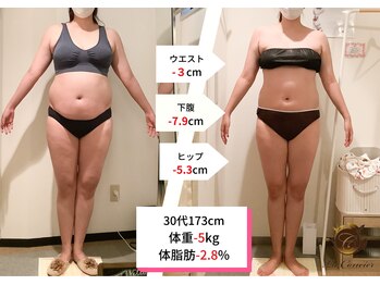 ラ コンシェル 三軒茶屋店/Before after【三軒茶屋店】