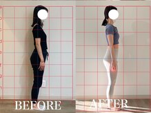 ルア(Lua)/反り腰改善＆ヒップアップ