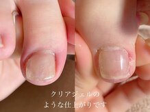 キラネイル アンド アイラッシュ by World Beauty(KIRA)/巻爪補正ペディグラス