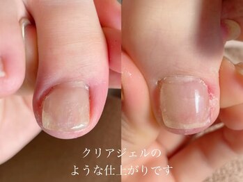 キラネイル アンド アイラッシュ by World Beauty(KIRA)/巻爪補正ペディグラス