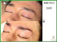 ひかり素肌/美眉ブロウ1回