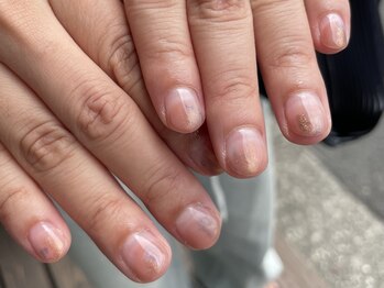 ハレ(80_hare_)/ニュアンス定額コース