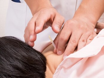 中目黒 佳鍼堂/初めての鍼でもこわくない！