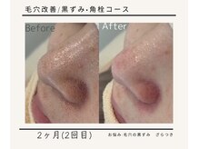 ルミエールフォートサイド(L’MIERE fortside)の雰囲気（【毛穴の黒ずみ/ニキビケア/シミ/たるみ改善】フォトに多数有）