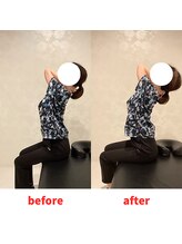 ナオル整体 福岡香椎院(NAORU整体)/30代女性施術事例【猫背】