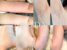 サロン ガトレオ(GatoLeo)の雰囲気（ボディのブツブツ/毛穴/毛孔性苔癬/黒ずみ/色素沈着など全身対応）