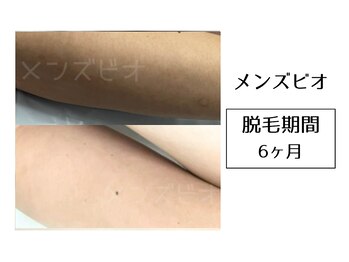 メンズビオ 神戸三宮店/