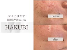 ハクビ(HAKUBI)