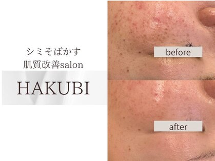 ハクビ(HAKUBI)の写真