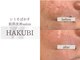 ハクビ(HAKUBI)の写真