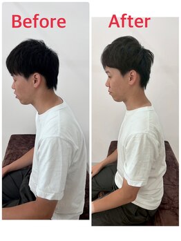 月の木整骨院/【施術後の変化】