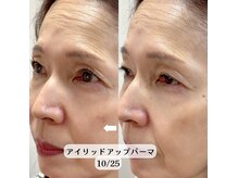 プリティアイ(pretty eye)/瞼も上がる！アイリッドアップ