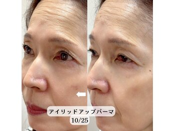 プリティアイ(pretty eye)/瞼も上がる！アイリッドアップ