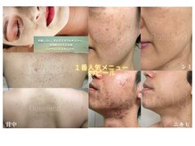 ローズフィールド(Rosefield)