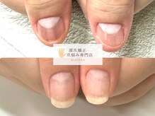 深爪矯正 爪悩み専門店 cocomo/(深爪/長さだし/フィルイン)