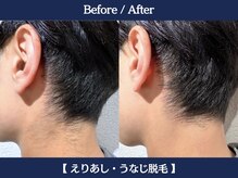 ランドマーク 中崎町(LANDMARK.)/《 襟足・うなじ 》